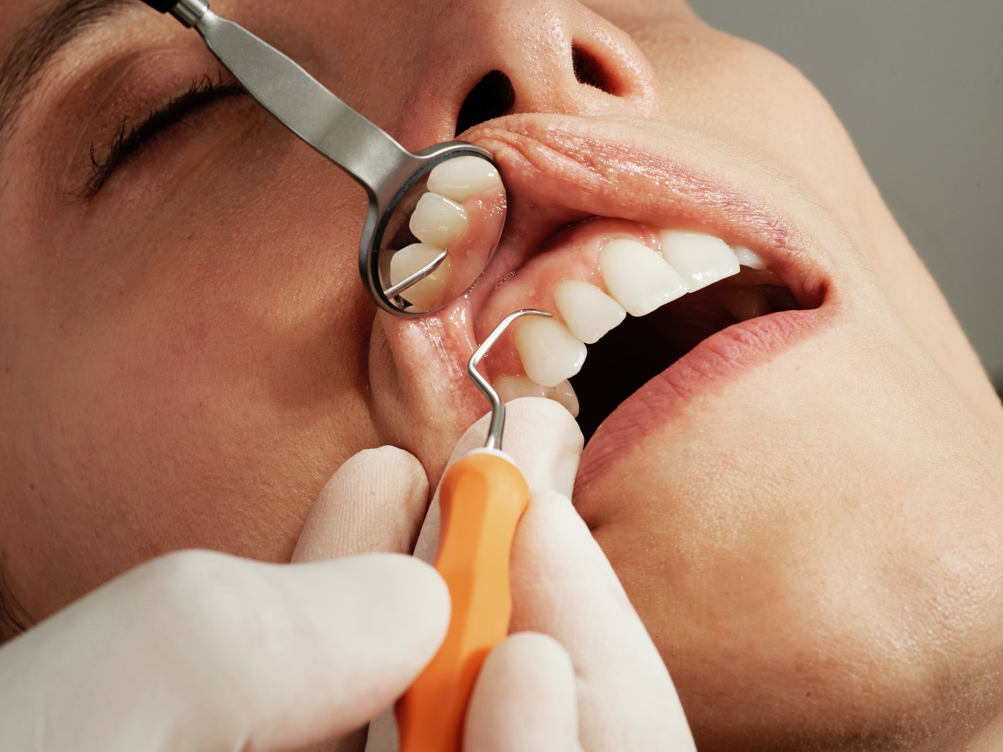 The icd 10 sleep apnea code what your dental team needs to know